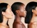 Strong solutions for increasing dermatology research diversity: Trust me,  I've got skin in the game | pharmaphorum